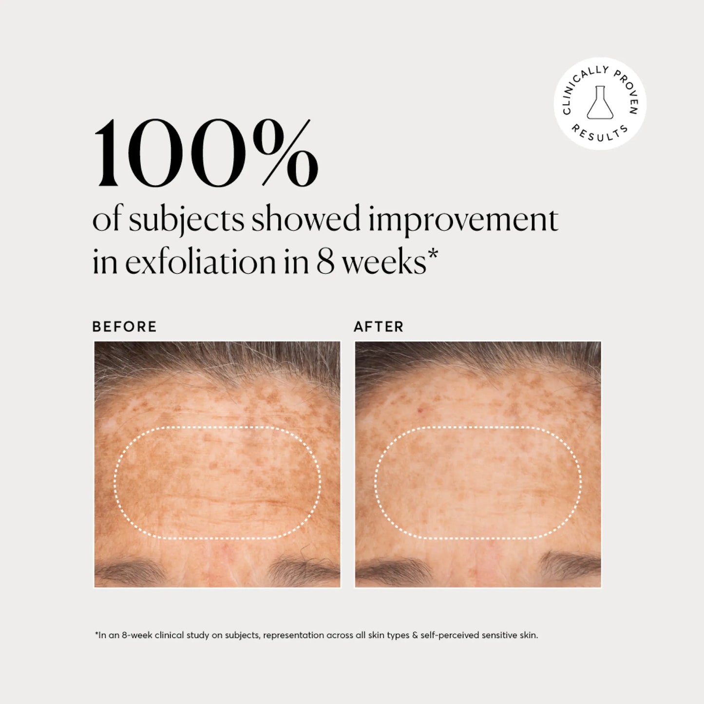 bha-liquid-exfoliant-2-t7 NATR-10027-Alt-Images-BHA-Liquid-Exfoliant-2_-03.webp